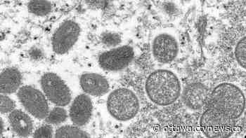 Monkeypox Ottawa: 8 new cases confirmed - CTV News Ottawa