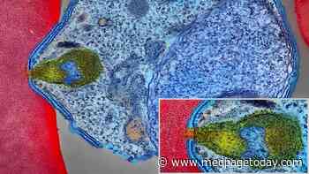 High Hopes for New Monoclonal Antibody for Malaria