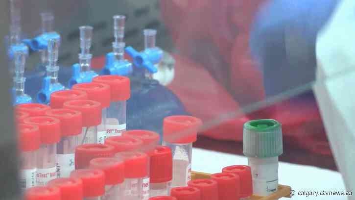 COVID-19 hospitalizations rise, Calgarians mixed on whether to react