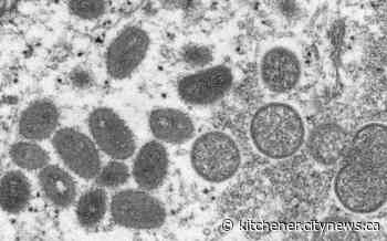 Wellington-Dufferin-Guelph sees third confirmed monkeypox case - Kitchener.CityNews.ca