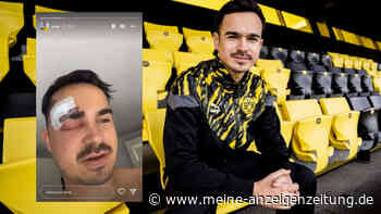 YouTuber Erné beschuldigt Ärzte nach Unfall: „Waren froh, als ich abgehauen bin“