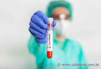 Varíola dos macacos: Sobe para 7 o número de casos em Cotia - Cotia e Cia