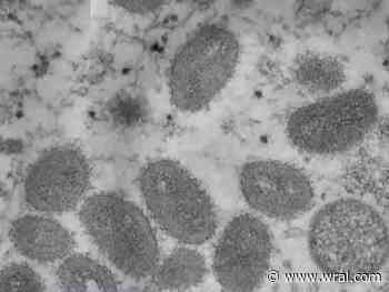 1st case of monkeypox confirmed in Cumberland County by health officials - WRAL News