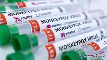 1st case of monkeypox confirmed in Waterloo region, says public health