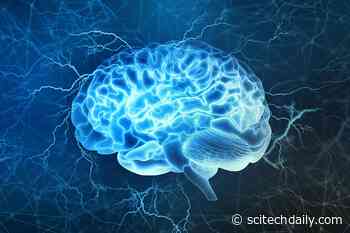 Scientists Find a Key Brain Difference Between Primates and Other Animals
