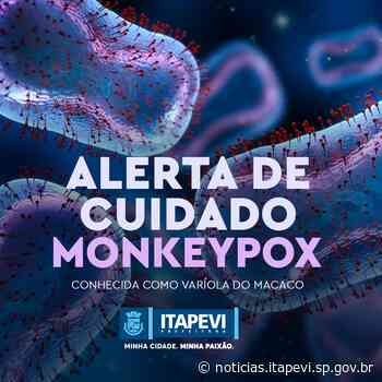 Saiba como reconhecer a Monkeypox - Agência Itapevi de Notícias - noticias.itapevi.sp.gov.br