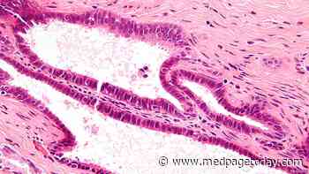 Two Sides of Endosalpingiosis: Benign Growth or Harbinger of Cancer?