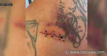 Man stabbed 10 times by Door Dash driver speaks for first time after attack - CBS News