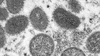 13News Now Vault: America's first monkeypox outbreak was in 2003