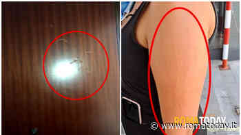 La vita impossibile di Suzana, rom assegnataria di casa popolare: da 3 anni insulti razzisti e aggressioni