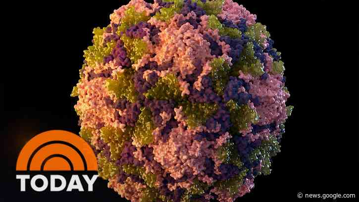 Health Officials Warn Of Potential Polio Outbreak - TODAY