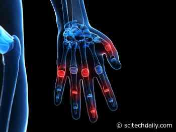 40-Year Mystery: Doctors Solve a Case of Unexplained Finger Pain