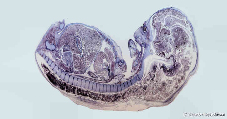 Scientists Grow Mouse Embryos Without Sperm Or Eggs