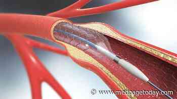 Stenting Hits Another Wall in Intracranial Stenosis Stroke