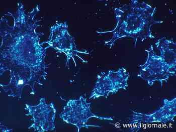 L'algoritmo che predice l’evoluzione dei tumori