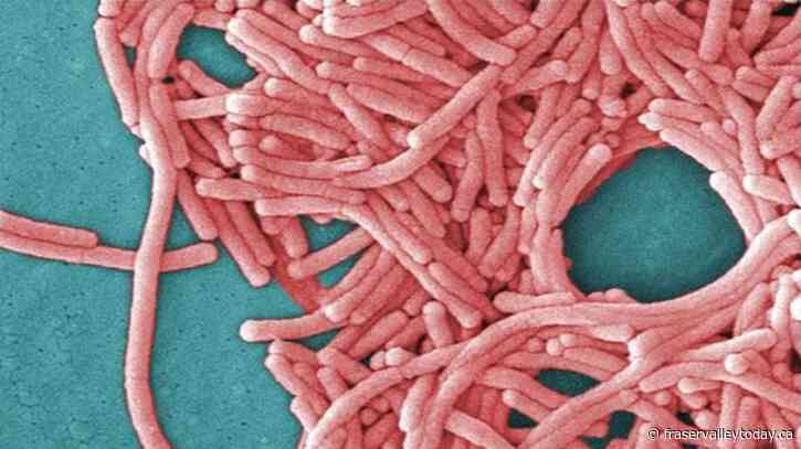 Montreal public health investigating after man dies from legionnaires’ disease