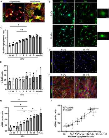 Matrix stiffness and architecture drive fibro-adipogenic progenitors' activation into myofibroblasts | Scientific Reports - Nature.com