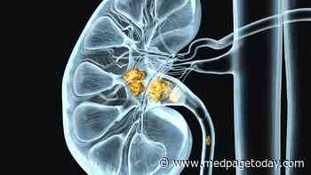 Removing Small Asymptomatic Kidney Stones Significantly Reduces Recurrence