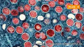 Wie sich die Affenpocken in Augsburg ausbreiten