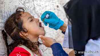 Polio largely vanished thanks to vaccines. So why is it now back in more countries?