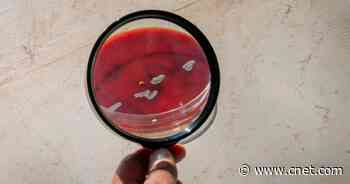 Top 5 Monkeypox Myths, Debunked     - CNET