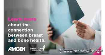 SUSAN G. KOMEN® SHARES TIPS TO LIVE A HEALTHIER LIFESTYLE