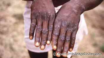 Monkeypox: Another Lesson in Global Health Neglect