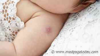 Nothing Lasts Forever, Including Infant BCG Vaccine Protection