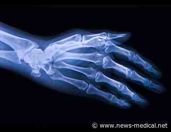 New gel-based cartilage substitute is stronger and more durable than the real thing