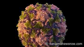 Polio detected in NYC's sewage, suggesting virus circulating - Nanaimo News NOW