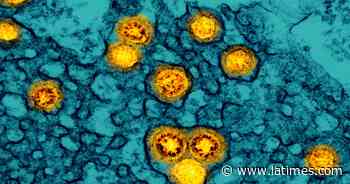 Omicron seen as milder coronavirus but scientists aren't sure - Los Angeles Times