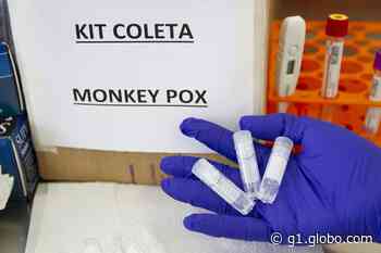 Resende investiga mais dois casos suspeitos de varíola dos macacos - Globo