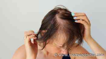 Can COVID-19 Cause Hair Loss?