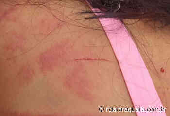 Após ser agredida pelo companheiro, mulher pede socorro em grupo do WhatsApp - rciararaquara.com.br
