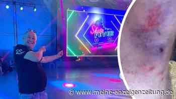 „Kein Kindergeburtstag“: „Bares für Rares“-Star Waldi zeigt blutige Verletzungen wegen RTL2-Show