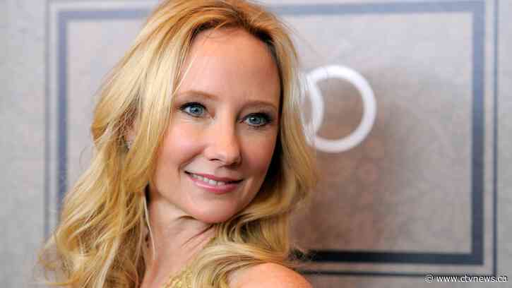 Anne Heche legally dead, remains on life support for donor evaluation