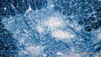 Canada to test wastewater for polio