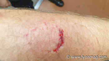 Près de Lyon : il cherche à tout prix à s'échapper et mord le bras d'un policier - Lyon Mag