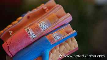 Daily Brief Health Care: Shockwave Medical Inc, Zhangzhou Pientzehuang Pharmaceutical Co., Ltd., Kaken Pharmaceutical, S&P 500, Tokyo Stock Exchange Tokyo Price Index Topix and more - Smartkarma