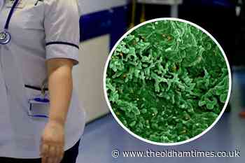 NHS issues monkeypox advice ahead of Manchester Pride - The Oldham Times