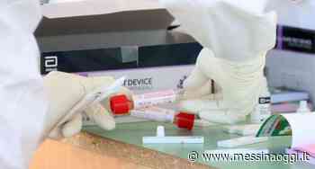 Calano ricoveri e tasso di positività, 293 casi a Messina - Messina Oggi