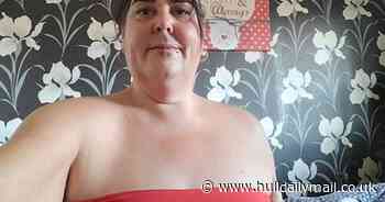 Flesh-eating infection sees woman lose 'half her bum cheek' - Hull Live