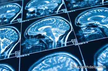 New Research Finds That People With Anorexia Have Smaller Brains