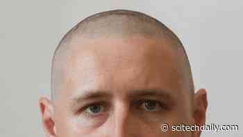 New Molecule Discovered That Strongly Stimulates Hair Growth