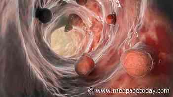 Risk-Adapted Screening for CRC Comparable to Established Strategies