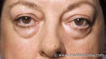 Clinical Challenges: Knowing When It's Thyroid Eye Disease