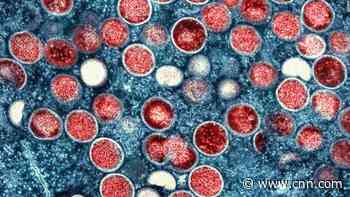 First possible case of human-to-dog monkeypox transmission 'not surprising,' WHO says