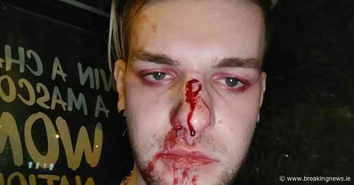 Young man assaulted in suspected homophobic attack on Dublin bus - BreakingNews.ie