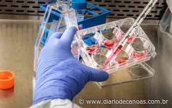 Morador de Esteio de 19 anos é diagnosticado com varíola dos macacos - Diário de Canoas