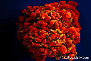 HIV Accelerates Aging by 5 Years